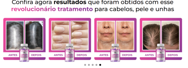 Cabelo, Pele & Unhas - Lizz ante Nutri - Imagem 3
