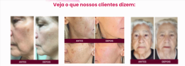 Rosa amazônica - Imagem 3