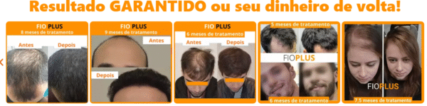 FIO PLUS - Imagem 3