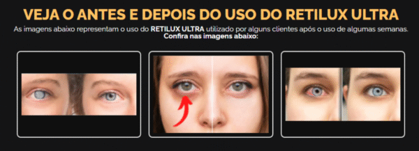 Retilux - Imagem 3